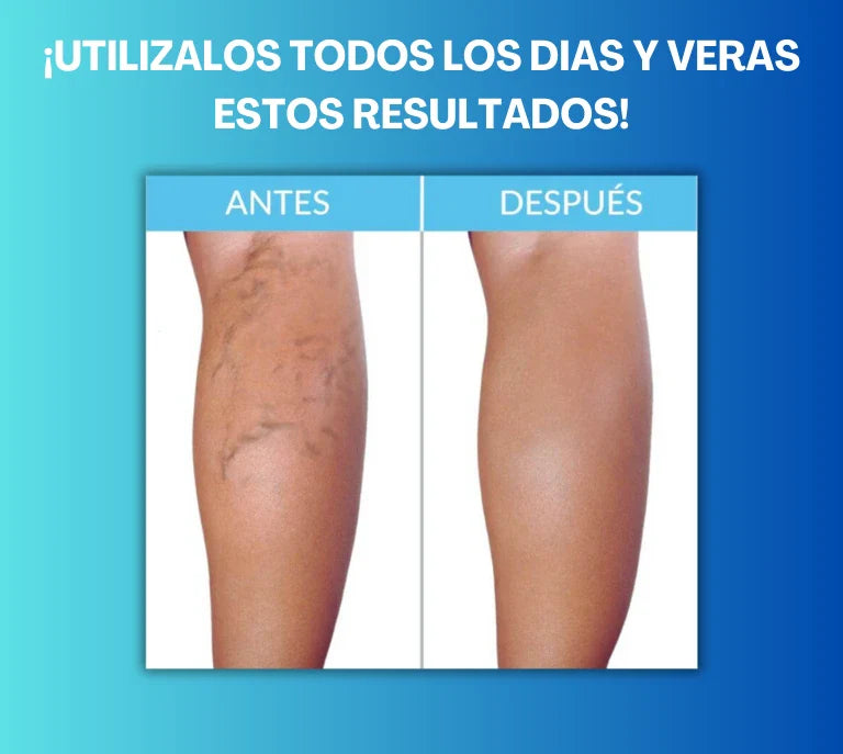 Parches Anti Várices (4 Packs de 12 parches c/u)