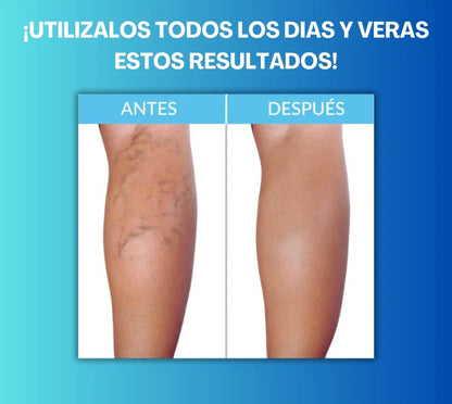 Parches Anti Várices (4 Packs de 12 parches c/u)